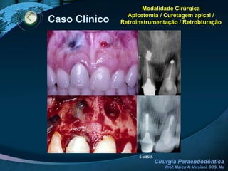 Modalidades Cirúrgicas3 mm