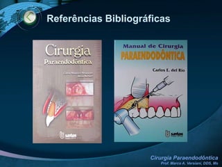 Caso ClínicoModalidade CirúrgicaApicetomia / Curetagem apical / Retroinstrumentação / Retrobturação1 ANO