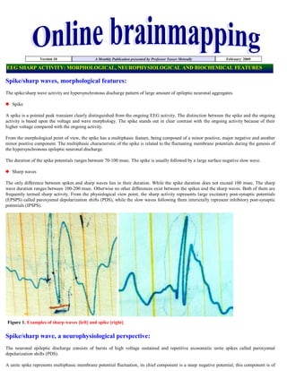 Version 10                   A Monthly Publication presented by Professor Yasser Metwally         February 2009

EEG SHARP ACTIVITY: MORPHOLOGICAL, NEUROPHYSIOLOGICAL AND BIOCHEMICAL FEATURES

Spike/sharp waves, morphological features:
The spike/sharp wave activity are hypersynchronous discharge pattern of large amount of epileptic neuronal aggregates.

   Spike

A spike is a pointed peak transient clearly distinguished from the ongoing EEG activity. The distinction between the spike and the ongoing
activity is based upon the voltage and wave morphology. The spike stands out in clear contrast with the ongoing activity because of their
higher voltage compared with the ongoing activity.

From the morphological point of view, the spike has a multiphasic feature, being composed of a minor positive, major negative and another
minor positive component. The multiphasic characteristic of the spike is related to the fluctuating membrane potentials during the genesis of
the hypersynchronous epileptic neuronal discharge.

The duration of the spike potentials ranges between 70-100 msec. The spike is usually followed by a large surface negative slow wave.

   Sharp waves

The only difference between spikes and sharp waves lies in their duration. While the spike duration does not exceed 100 msec. The sharp
wave duration ranges between 100-200 msec. Otherwise no other differences exist between the spikes and the sharp waves. Both of them are
frequently termed sharp activity. From the physiological view point, the sharp activity represents large excitatory post-synaptic potentials
(EPSPS) called paroxysmal depolarization shifts (PDS), while the slow waves following them interictally represent inhibitory post-synaptic
potentials (IPSPS).




 Figure 1. Examples of sharp waves [left] and spike [right]


Spike/sharp wave, a neurophysiological perspective:
The neuronal epileptic discharge consists of bursts of high voltage sustained and repetitive axosomatic unite spikes called paroxysmal
depolarization shifts (PDS).

A unite spike represents multiphasic membrane potential fluctuation, its chief component is a steep negative potential, this component is of
 