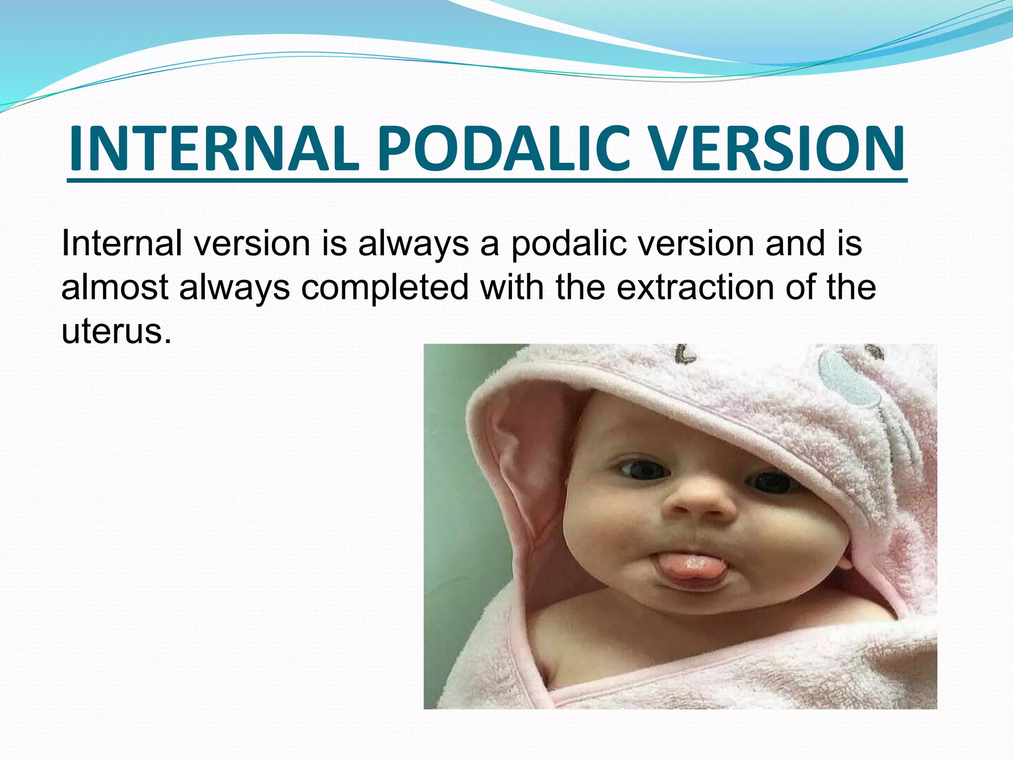 INTERNAL PODALIC VERSION
Internal version is always a podalic version and is
almost always completed with the extraction of the
uterus.
 