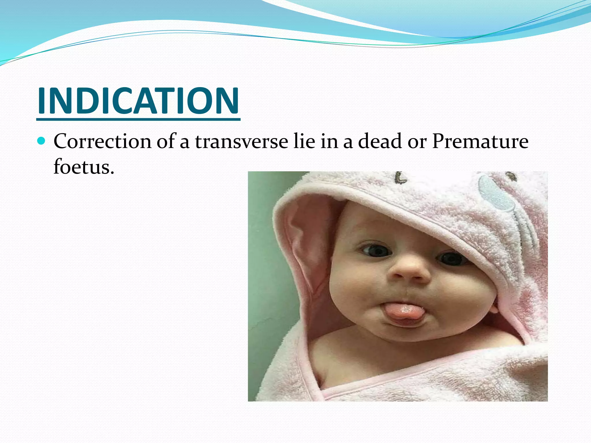INDICATION
 Correction of a transverse lie in a dead or Premature
foetus.
 
