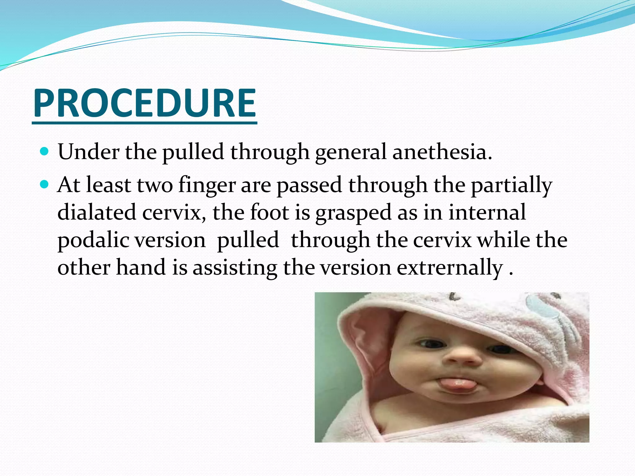 PROCEDURE
 Under the pulled through general anethesia.
 At least two finger are passed through the partially
dialated cervix, the foot is grasped as in internal
podalic version pulled through the cervix while the
other hand is assisting the version extrernally .
 