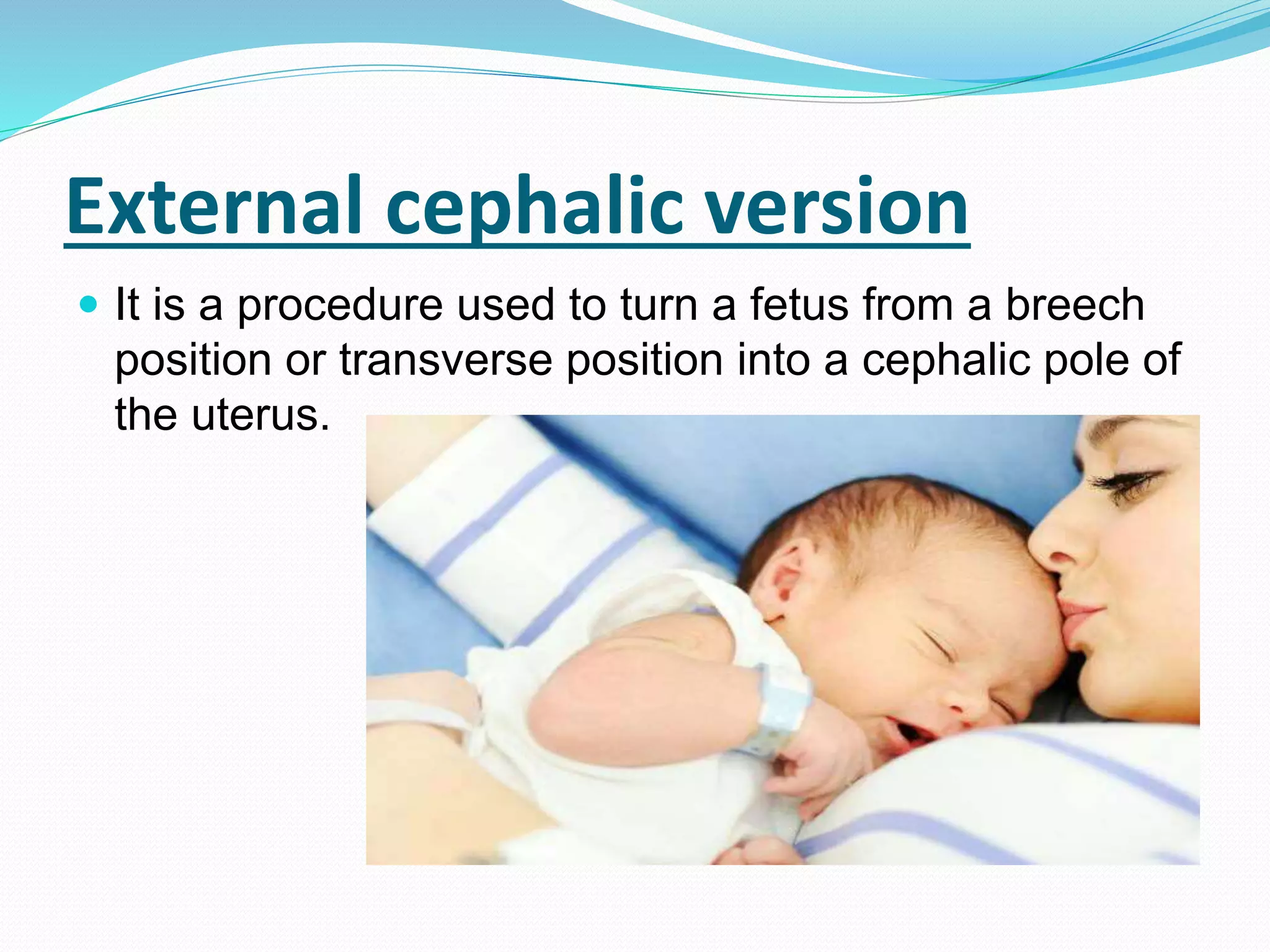 External cephalic version
 It is a procedure used to turn a fetus from a breech
position or transverse position into a cephalic pole of
the uterus.
 