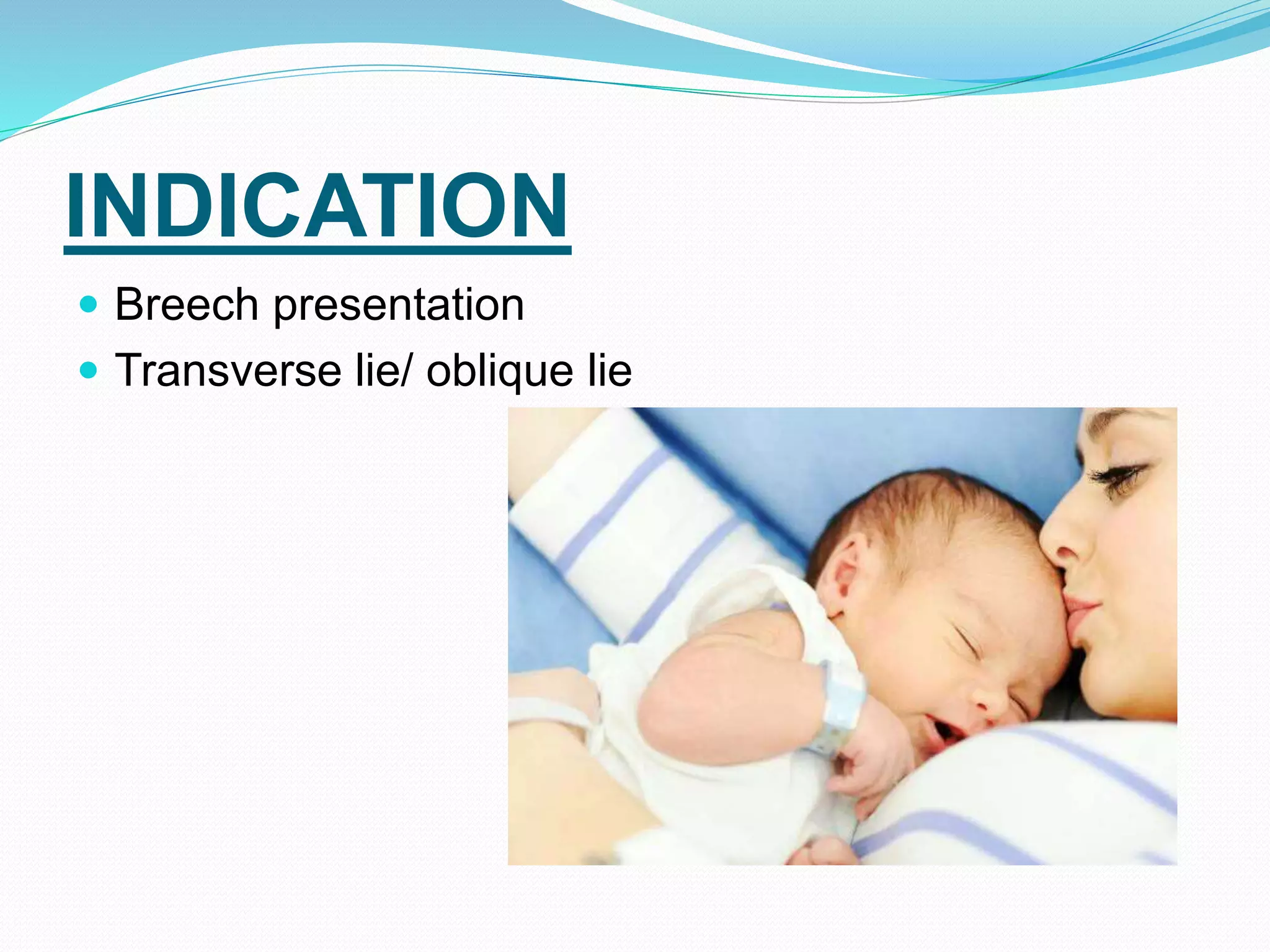 INDICATION
 Breech presentation
 Transverse lie/ oblique lie
 