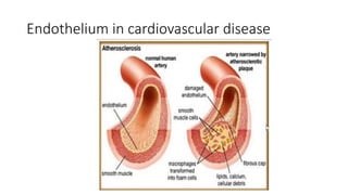 Endothelium in cardiovascular disease
 