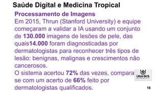 Processamento de Imagens
Em 2015, Thrun (Stanford University) e equipe
começaram a validar a IA usando um conjunto
de 130.000 imagens de lesões de pele, das
quais14.000 foram diagnosticadas por
dermatologistas para reconhecer três tipos de
lesão: benignas, malignas e crescimentos não
cancerosos.
O sistema acertou 72% das vezes, comparando-
se com um acerto de 66% feito por
dermatologistas qualificados. 18
Saúde Digital e Medicina Tropical
 