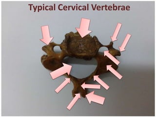 Typical Cervical Vertebrae
 