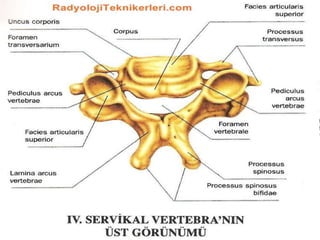 Vertebralar
