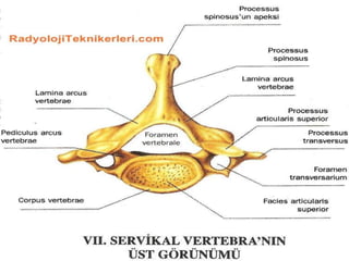 Vertebralar