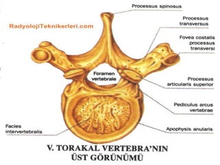 Vertebralar