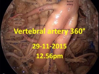 Vertebral artery 360°
1-1-2016
10.45am
 