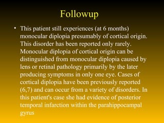 Followup This patient still experiences (at 6 months) monocular diplopia presumably of cortical origin. This disorder has been reported only rarely. Monocular diplopia of cortical origin can be distinguished from monocular diplopia caused by lens or retinal pathology primarily by the later producing symptoms in only one eye. Cases of cortical diplopia have been previously reported (6,7) and can occur from a variety of disorders. In this patient's case she had evidence of posterior temporal infarction within the parahippocampal gyrus 