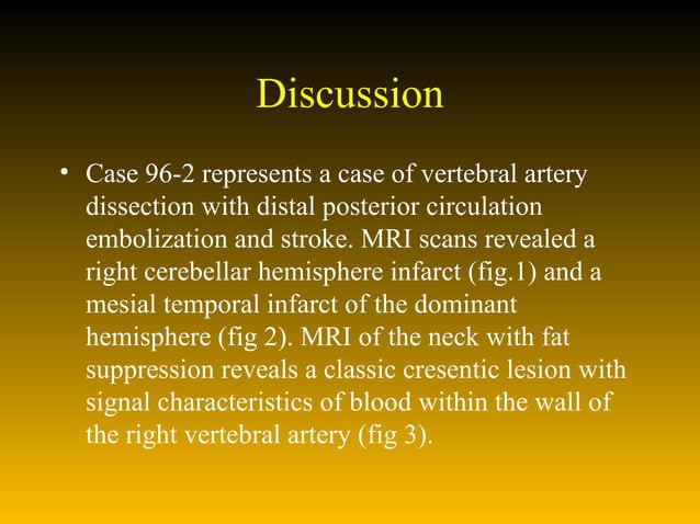 Vertebral artery dissection | PPT | Brain and Nervous System Disorders ...
