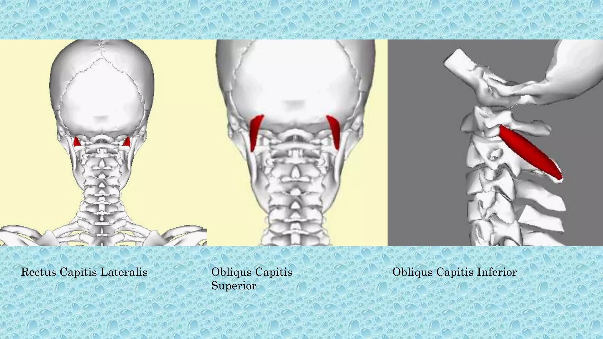 Rectus Capitis Lateralis Obliqus Capitis
Superior
Obliqus Capitis Inferior
 