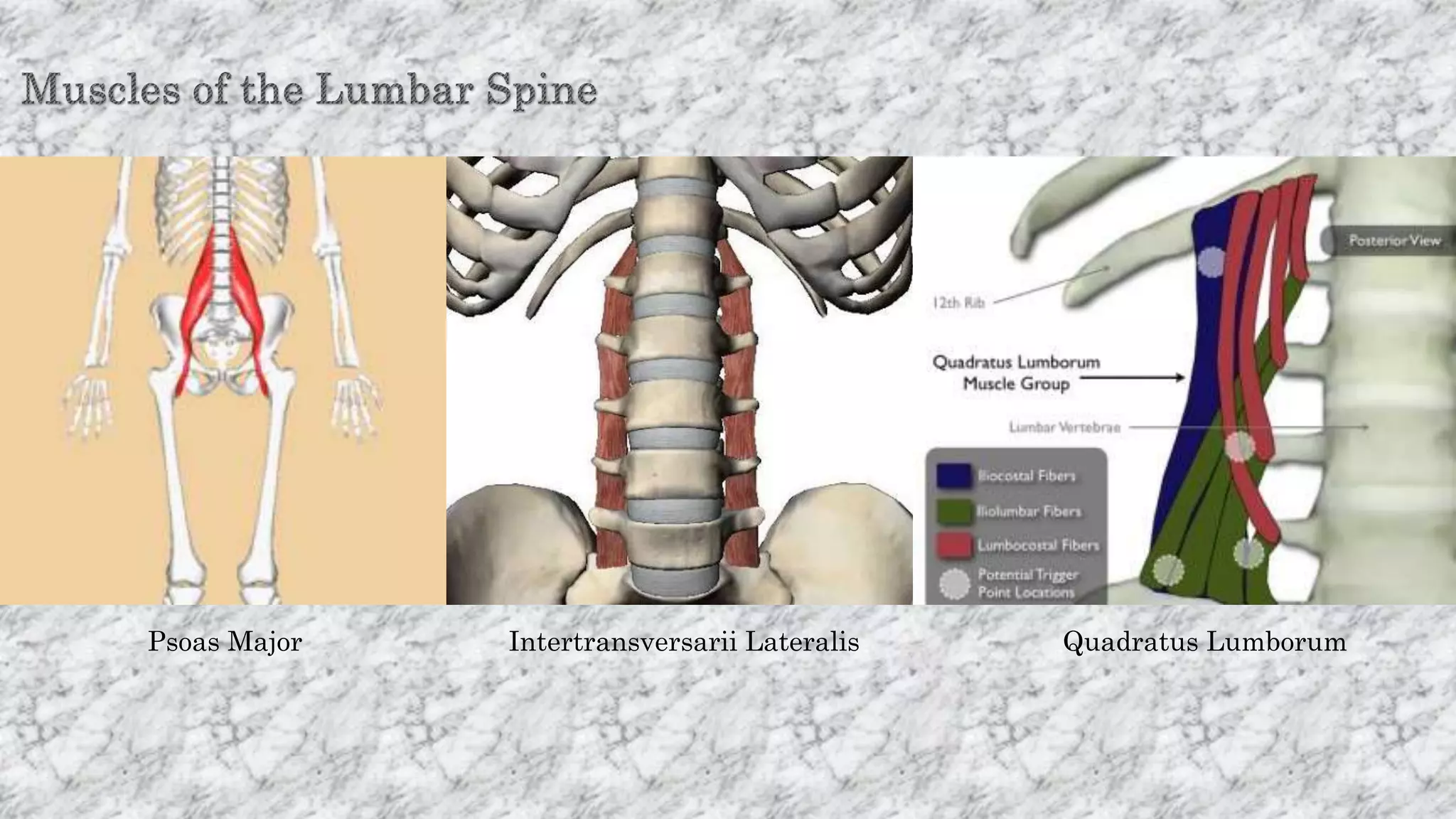 Psoas Major Intertransversarii Lateralis Quadratus Lumborum
 
