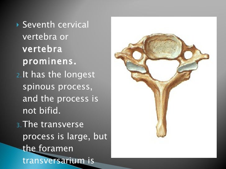 Vertebral Column And Contents Of The Vertebral Canal