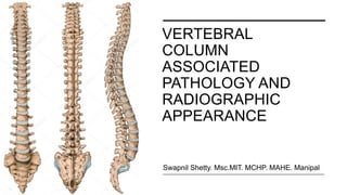 VERTEBRAL
COLUMN
ASSOCIATED
PATHOLOGY AND
RADIOGRAPHIC
APPEARANCE
Swapnil Shetty. Msc.MIT. MCHP. MAHE. Manipal
 