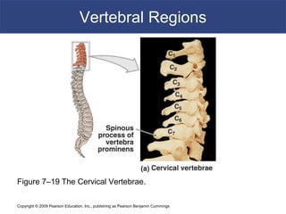Copyright © 2009 Pearson Education, Inc., publishing as Pearson Benjamin Cummings
Vertebral Regions
Figure 7–19 The Cervical Vertebrae.
 