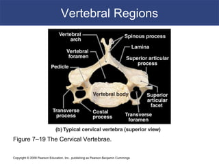 Copyright © 2009 Pearson Education, Inc., publishing as Pearson Benjamin Cummings
Vertebral Regions
Figure 7–19 The Cervical Vertebrae.
 