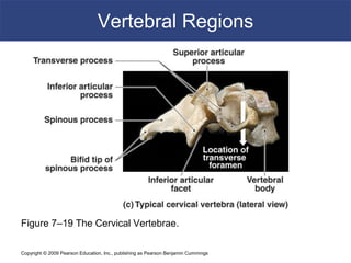 Copyright © 2009 Pearson Education, Inc., publishing as Pearson Benjamin Cummings
Vertebral Regions
Figure 7–19 The Cervical Vertebrae.
 