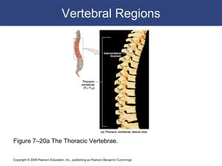 Copyright © 2009 Pearson Education, Inc., publishing as Pearson Benjamin Cummings
Vertebral Regions
Figure 7–20a The Thoracic Vertebrae.
 