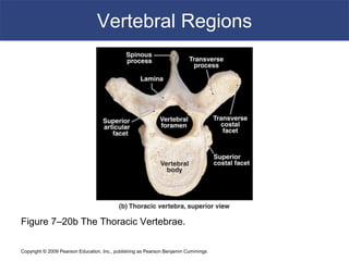 Copyright © 2009 Pearson Education, Inc., publishing as Pearson Benjamin Cummings
Vertebral Regions
Figure 7–20b The Thoracic Vertebrae.
 