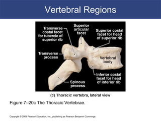 Copyright © 2009 Pearson Education, Inc., publishing as Pearson Benjamin Cummings
Vertebral Regions
Figure 7–20c The Thoracic Vertebrae.
 