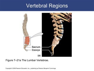 Copyright © 2009 Pearson Education, Inc., publishing as Pearson Benjamin Cummings
Vertebral Regions
Figure 7–21a The Lumbar Vertebrae.
 