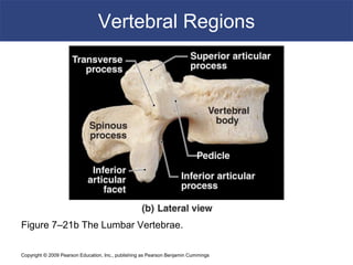 Copyright © 2009 Pearson Education, Inc., publishing as Pearson Benjamin Cummings
Vertebral Regions
Figure 7–21b The Lumbar Vertebrae.
 