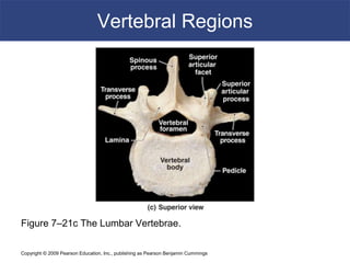 Copyright © 2009 Pearson Education, Inc., publishing as Pearson Benjamin Cummings
Vertebral Regions
Figure 7–21c The Lumbar Vertebrae.
 