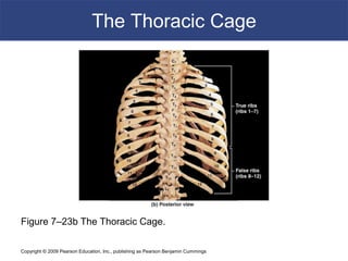 Copyright © 2009 Pearson Education, Inc., publishing as Pearson Benjamin Cummings
The Thoracic Cage
Figure 7–23b The Thoracic Cage.
 