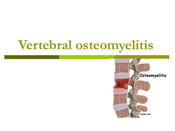 Vertebral osteomyelitis