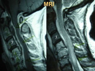 MRI
3
3
 