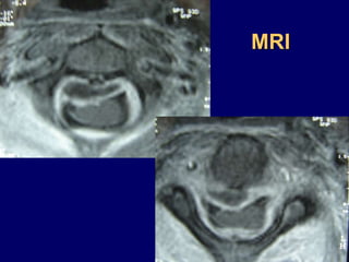MRI
 