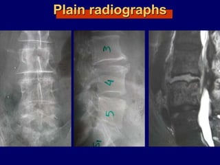 Plain radiographs
 