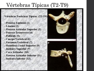 Vértebras Típicas (T2-T9) 
 