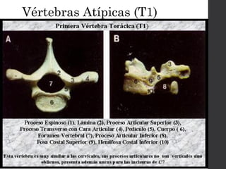 Vértebras Atípicas (T1) 
 
