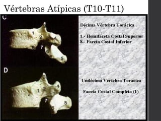 Vértebras Atípicas (T10-T11) 
 
