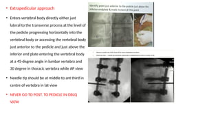 VERTEBROPLASTY AND KYPHOPLASTY- Eagle view | PPTX