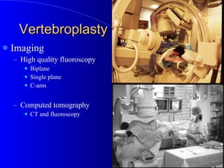 Vertebroplasty Imaging High quality fluoroscopy Biplane Single plane C-arm Computed tomography CT and fluoroscopy 