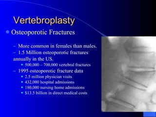 Vertebroplasty Osteoporotic Fractures More common in females than males. 1.5 Million osteoporotic fractures  annually in the US. 500,000 – 700,000 vertebral fractures 1995 osteoporotic fracture data 2.5 million physician visits 432,000 hospital admissions 180,000 nursing home admissions $13.5 billion in direct medical costs 