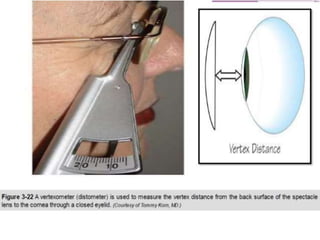 Vertex distance | PPTX