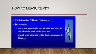 HOW TO MEASURE VD?
 