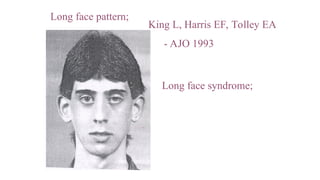 vertical discrepensies.ppt.............. | PPT