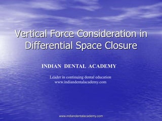 Vertical Force Consideration in
Differential Space Closure
INDIAN DENTAL ACADEMY
Leader in continuing dental education
www.indiandentalacademy.com
www.indiandentalacademy.com
 