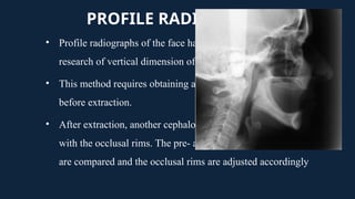 Vertical Radiograph VERTICAL JAW RELATION in compleedenture.pptx