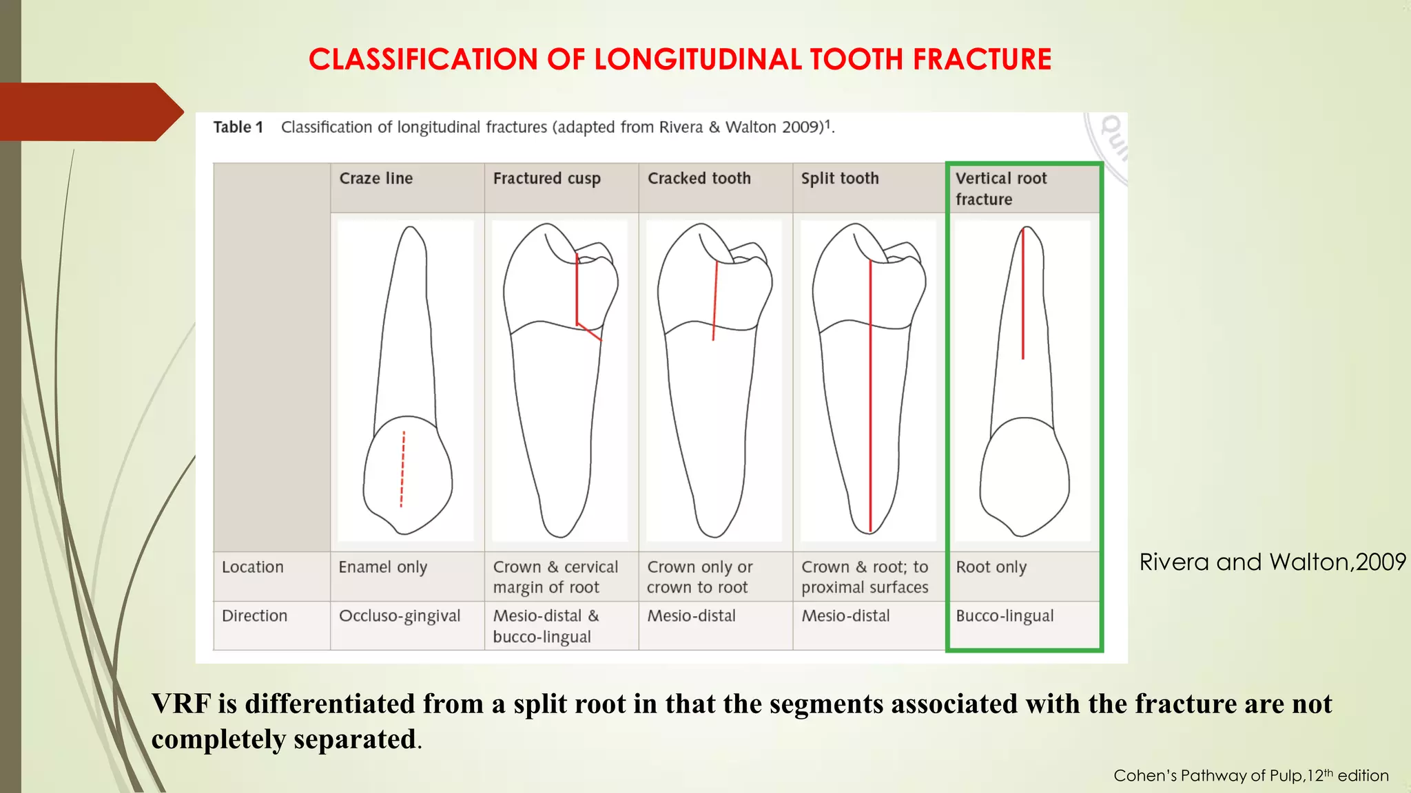VERTICAL ROOT FRACTURE pdf