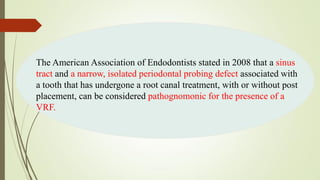 The American Association of Endodontists stated in 2008 that a sinus
tract and a narrow, isolated periodontal probing defect associated with
a tooth that has undergone a root canal treatment, with or without post
placement, can be considered pathognomonic for the presence of a
VRF.
 