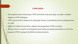 • The symptoms and/or clinical signs of VRF, particularly in the early stages, can make a confident
diagnosis of VRF challenging.
• CBCT may be useful to diagnose the radiographic features of periradicular bone loss pathognomonic
of a VRF.
• High-level evidence for prevalence, diagnosis and management of VRFs is lacking.
• Therefore, there is a need for well-designed clinical studies assessing the presentation, as well as the
prognosis of VRFs managed with different treatment protocols.
CONCLUSION
 