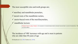 The most susceptible sites and tooth groups are;
 maxillary and mandibular premolars,
 mesial roots of the mandibular molars,
 mesio-buccal roots of the maxillarymolars,
 mandibular incisors
Tamse A, Fuss Z, Lustig J, Kaplavi J. An evaluation of endodontically treated vertically fractured teeth. Journal of endodontics. 199
Jul1;25(7):506-8.
The incidence of VRF increases with age and is most in patients
who are older than 40 years of age
(PradeepKumar et al., 2016; Yoshino et al., 2015).
 